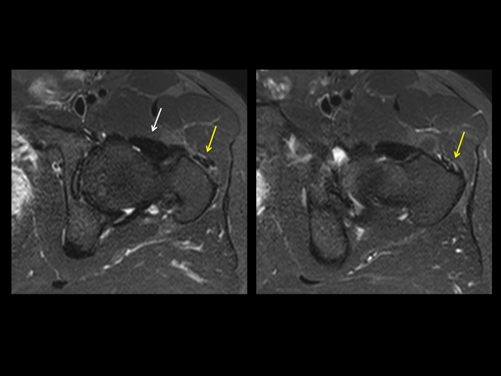 Figure 3 for case joint capsule ( RID6072 )